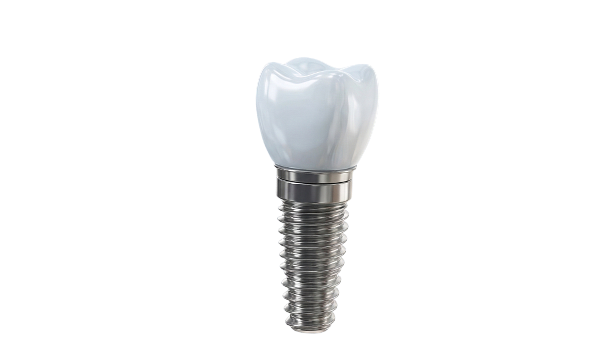Realistic Dental Implant