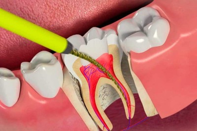 course-thumbnail